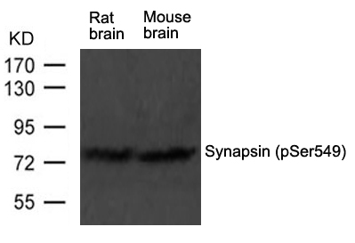 Western blot analysis of extract from rat brain and mouse brain tissue using Synapsin(phospho-Ser549) Antibody using #11568