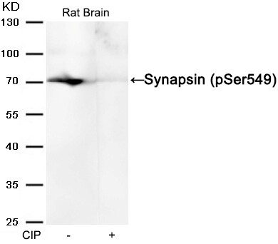 Western blot analysis of extracts from Rat brain tissue or calf intestinal phosphatase (CIP), using Synapsin (phospho-Ser549) Antibody #11568.
