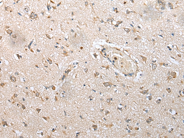 Immunohistochemical analysis of paraffin-embedded Human brain tissue using #43376 at dilution 1/25,