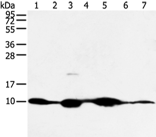 Gel: 12%SDS-PAGE Lysate: 40 μg Lane 1-7: Mouse muscle and human fetal muscle tissue, mouse heart tissue and PC3 cell, mouse kidney and small intestines tissue, 231 cell Primary antibody: 1/300 dilution Secondary antibody: Goat anti rabbit IgG at 1/8000 dilution Exposure time: 5 minutes