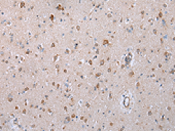Immunohistochemical analysis of paraffin-embedded Human brain tissue using #43250 at dilution 1/40.