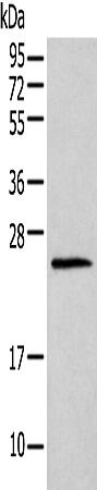 Gel: 12%SDS-PAGE Lysate: 40 μg Lane: Mouse lung tissue Primary antibody: 1/400 dilution Secondary antibody: Goat anti rabbit IgG at 1/8000 dilution Exposure time: 1 minute