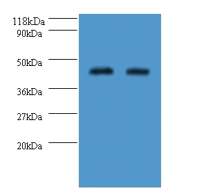 All lanes : Probable sarcosine oxidase antibody at 2ug/ml Lane 1 : 293T whole cell lysate Lane 2 : EC109 whole cell lysate Secondary Goat polyclonal to Rabbit IgG at 1/10000 dilution Predicted band size :46KDa Observed band size:46KDa