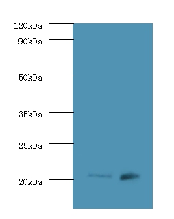 All lanes:GTPase Hras antibody at 2ug/ml Lane1:293T whole cell lysate Lane2::mouse brain tissue Secondary Goat polyclonal to Rabbit IgG at 1/10000 dilution Predicted band size:21kda Observed band size:21kda