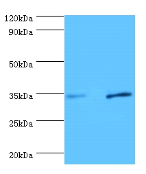 All lanes:Urokinase plasminogen activator surface receptor antibody at 2ug/ml Lane 1:293T whole cell lysate Lane 2:rat brain tissue secondary Goat polyclonal to rabbit at 1/10000 dilution predicted band size :34kDa observed band size :34kDa