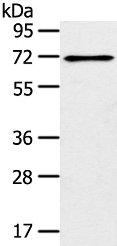 Gel: 8%SDS-PAGE Lysate: 40ug 293T cellPrimary antibody: 1/300 dilution Secondary antibody dilution: 1/8000Exposure time: 1 minute
