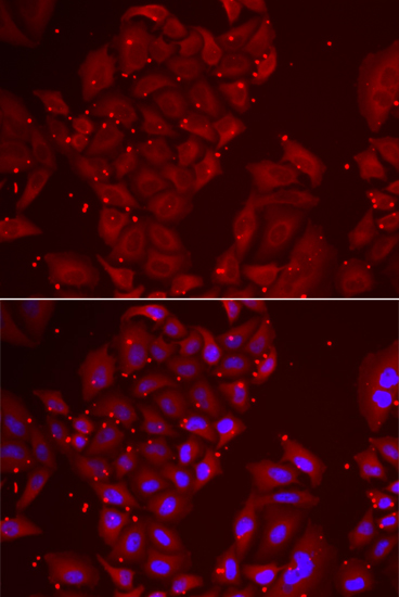 Immunofluorescence analysis of U2OS cell using TPP2 antibody. Blue: DAPI for nuclear staining.