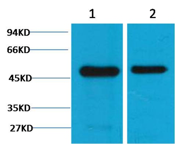 Western blot analysis of 1) Mouse Brain Tissue , 2) Rat Brain tissue, using #38095 diluted at 1:2,000.