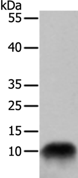 Gel: 15%+10%SDS-PAGE Lysate: 50ug 293T cell Primary antibody: 1/700 dilution Secondary antibody dilution: 1/8000 Exposure time: 30 seconds