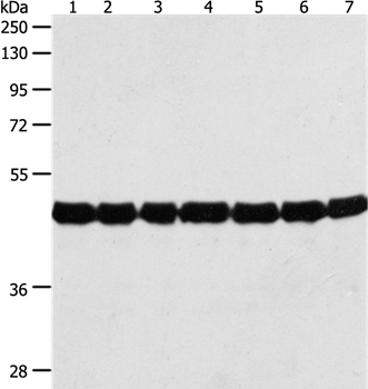 Gel: 10%SDS-PAGE Lysates (from left to right): Cinnamomum camphora leaves, Nicotiana tabacum leaves, Triticum aestivuml leaves, Arabidopsis thaliana leaves, Brassica campestris flowers, Brassica campestris leaves, Vicit Faba leaves Amount of lysate: 50ug per lane Primary antibody: 1/500 dilution Secondary antibody dilution: 1/8000 Exposure time: 20 seconds