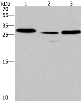 Gel: 10%SDS-PAGE Lysates (from left to right): Human fetal liver tissue and mouse heart tissue,human testis tissue Amount of lysate: 40ug per lane Primary antibody: 1/475 dilution Secondary antibody dilution: 1/8000 Exposure time: 1 minute