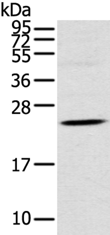 Gel: 12%SDS-PAGE Lysate: 40ug Human fetal brain tissuePrimary antibody: 1/550 dilution Secondary antibody dilution: 1/8000Exposure time: 2 minutes