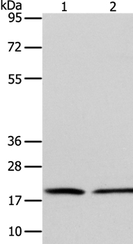 Gel: 15+12%SDS-PAGE Lysates (from left to right): Jurkat and RAW264.7 cell Amount of lysate: 40ug per lane Primary antibody: 1/600 dilution Secondary antibody dilution: 1/8000 Exposure time: 1 minute