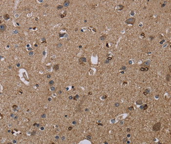 Immunohistochemical analysis of paraffin-embedded Human brain tissue using #36874 at dilution 1/20.