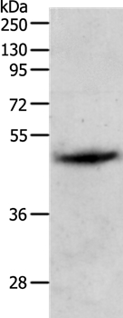 Gel: 10%SDS-PAGE Lysates (from left to right): Human liver cancer tissue Amount of lysate: 60ug per lane Primary antibody: 1/1000 dilution Secondary antibody dilution: 1/8000 Exposure time: 10 minutes