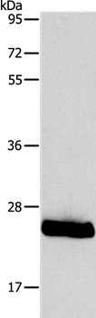 Gel: 10%SDS-PAGE Lysates (from left to right): Mouse trachea tissue Amount of lysate: 40ug per lane Primary antibody: 1/800 dilution Secondary antibody dilution: 1/8000 Exposure time: 20 seconds
