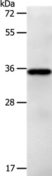 Gel: 10%SDS-PAGE Lysate: 40ug Jurkat cell Primary antibody: 1/1200 dilution Secondary antibody dilution: 1/8000 Exposure time: 30 seconds