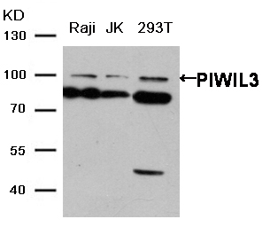 Gel: 6%SDS-PAGE Lysate: Raji、JK and 293T cell Primary antibody: 1/200 dilution Secondary antibody dilution: 1/8000 Exposure time: 2 minutes