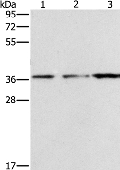 Gel: 10%SDS-PAGE Lysates (from left to right): Mouse liver tissue and A172 cell, human prostate tissue Amount of lysate: 40ug per lane Primary antibody: 1/1500 dilution Secondary antibody dilution: 1/8000 Exposure time: 1 minute