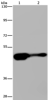 Gel: 6%SDS-PAGE Lysates (from left to right): Mouse liver tissue and HepG2 cell Amount of lysate: 40ug per lane Primary antibody: 1/430 dilution Secondary antibody dilution: 1/8000 Exposure time: 2 minutes