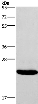 Gel: 8%SDS-PAGE Lysate: 40ug Riji cell Primary antibody: 1/400 dilution Secondary antibody dilution: 1/8000 Exposure time: 10 seconds