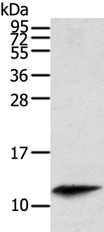 Gel: 12%SDS-PAGE Lysate: 40ug Mouse spleen tissuePrimary antibody: 1/200 dilution Secondary antibody dilution: 1/8000Exposure time: 40 seconds