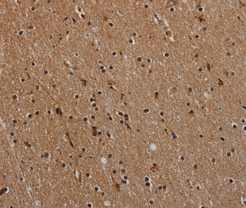 Immunohistochemical analysis of paraffin-embedded Human brain tissue using #37768 at dilution 1/40.