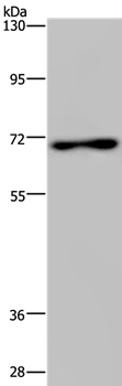 Gel: 6%SDS-PAGE Lysates (from left to right): Mouse spleen tissue Amount of lysate: 40ug per lane Primary antibody: 1/200 dilution Secondary antibody dilution: 1/8000 Exposure time: 5 minutes