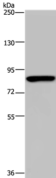 Gel: 6%SDS-PAGE Lysate: 40ug Hela cell Primary antibody: 1/200 dilution Secondary antibody dilution: 1/8000 Exposure time: 3 minutes