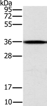 Gel: 10%SDS-PAGE Lysate: 40ug Jurkat cell Primary antibody: 1/200 dilution Secondary antibody dilution: 1/8000 Exposure time: 1 second