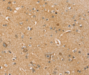 Immunohistochemical analysis of paraffin-embedded Human brain tissue using #37945 at dilution 1/45.