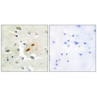 Immunohistochemistry analysis of paraffin-embedded human brain tissue, using DNA Polymerase ζ antibody #33602.