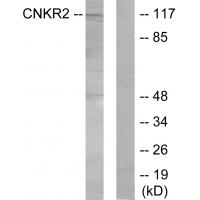 Western blot analysis of extracts from Jurkat cells, using CNKR2 antibody #33998.