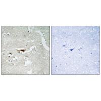 Immunohistochemistry analysis of paraffin-embedded human brain tissue, using IPKB antibody #34054.