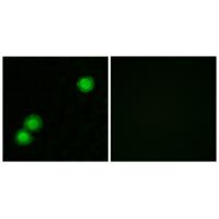 Immunofluorescence analysis of MCF-7 cells, using IPKB antibody #34054.