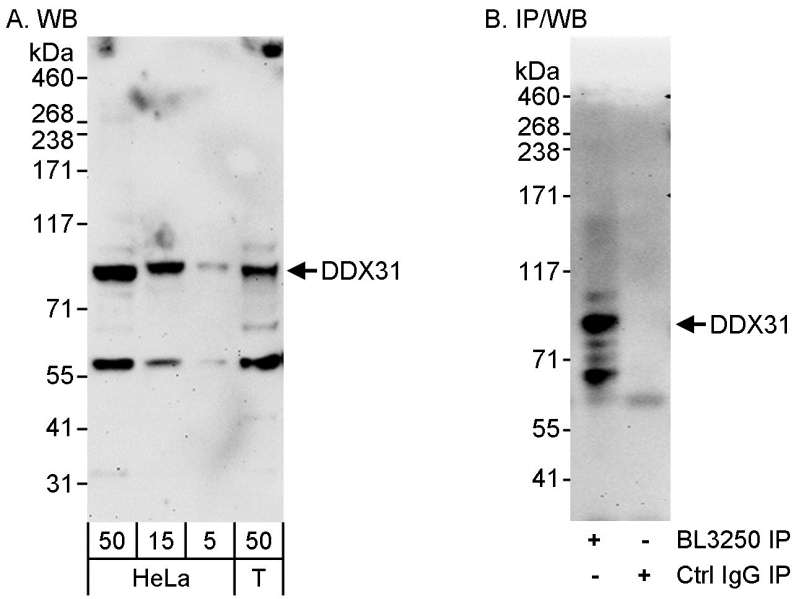 <b>Detection of Human DDX31 by Western Blot and Immunoprecipitation.<i> </i></b>Samples: Whole cell lysate from HeLa (5, 15 and 50 µg for WB; 1 mg for IP, 20% of IP loaded) and 293T (T; 50 µg) cells.  <i>Antibodies:</i> Affinity purified rabbit anti-DDX31 antibody BL3250 (Cat. No. A300-787A) used for WB at 0.4 µg/ml (A) and 1 µg/ml (B) and used for IP at 3 µg/mg lysate (B).   <i>Detection: </i>Chemiluminescence with exposure times of 3 minutes (A and B). <br />  <br />  <br />   <br />