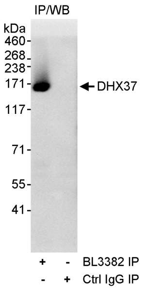 <b>Detection of Human DHX37 by Western Blot of Immunoprecipitate. </b><i>Samples: </i>Whole cell lysate (1 mg for IP, 20% of IP loaded) from HeLa cells.  <i>Antibodies: </i>Affinity purified rabbit anti-DHX37 antibody BL3382 (Cat. No. A300-857A) used for IP at 3 µg/mg lysate. For blotting DHX37, rabbit anti-DHX37 antibody BL3378 was used at 1 µg/ml.  <i>Detection:</i> Chemiluminescence with an exposure time of 30 seconds. <br />  <br />  <br />   <br />