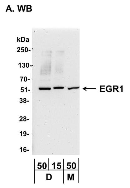 <b>Detection of Mouse EGR1 by Western Blot. </b> <i>Samples:</i>  Whole cell lysate from mouse bone marrow dendritic cells (D; 50 and 15 µg), and NIH3T3 cells (M; 50 µg).   <i> Antibodies:</i> Affinity purified rabbit anti-EGR1 antibody A303-391A used for WB at 0.4 µg/ml.    <i>Detection:</i> Chemiluminescence with an exposure time of 3 minutes. <br />  <br />  <br />   <br />