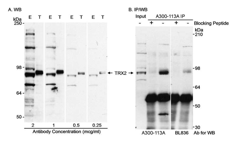 <b>Detection of Human Trithorax 2 by Western Blot and Immunoprecipitation.</b>  <i>Samples</i>: A. Whole cell lysate (100 µg - E; 10 µg - T) from 293T cells that were untreated (E) or transfected with an expression construct containing the residues c-terminal to the consensus cleavage site within TRX2 (T).  B.  Whole cell lysate (100 µg - Input; one 10 cm plate for IP) from untreated 293T cells.  <i>Antibodies</i>:  Affinity purified rabbit anti-TRX2 antibody A300-113A used at the indicated concentrations for WB (A) and 10 µg/plate for IP (B).   Immunoprecipitated TRX2 was detected by WB using A300-113A or rabbit anti-TRX2 antibody BL836.  <i>Detection</i>: Chemiluminescence with exposure times of 10 (A) or 1 seconds (B). <br />  <br />  <br />   <br />