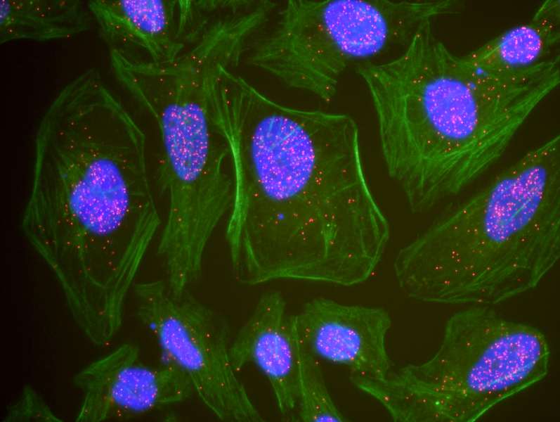 <b>This antibody is qualified for the Proximity Ligation Assay (PLA). </b>PLA uses paired antibodies, so please refer to the PLA page of our website for specific imaging obtained by pairing this antibody with other qualified antibodies. The above image shows representative results for PLA using three color fluorescence, including DAPI stained nuclei (blue), phalloidin stained cytoplasmic F-actin (green), and PLA positive signal (red). <br />  <br />  <br />   <br />