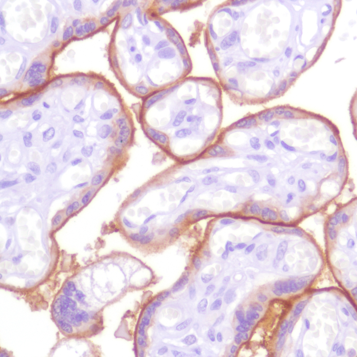 Human placenta stained with anti-PD-L1 antibody