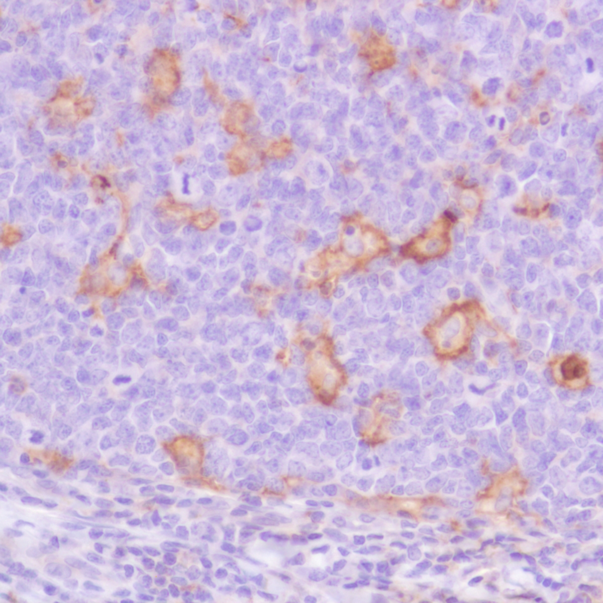 Human tonsil stained with anti-PD-L1 antibody