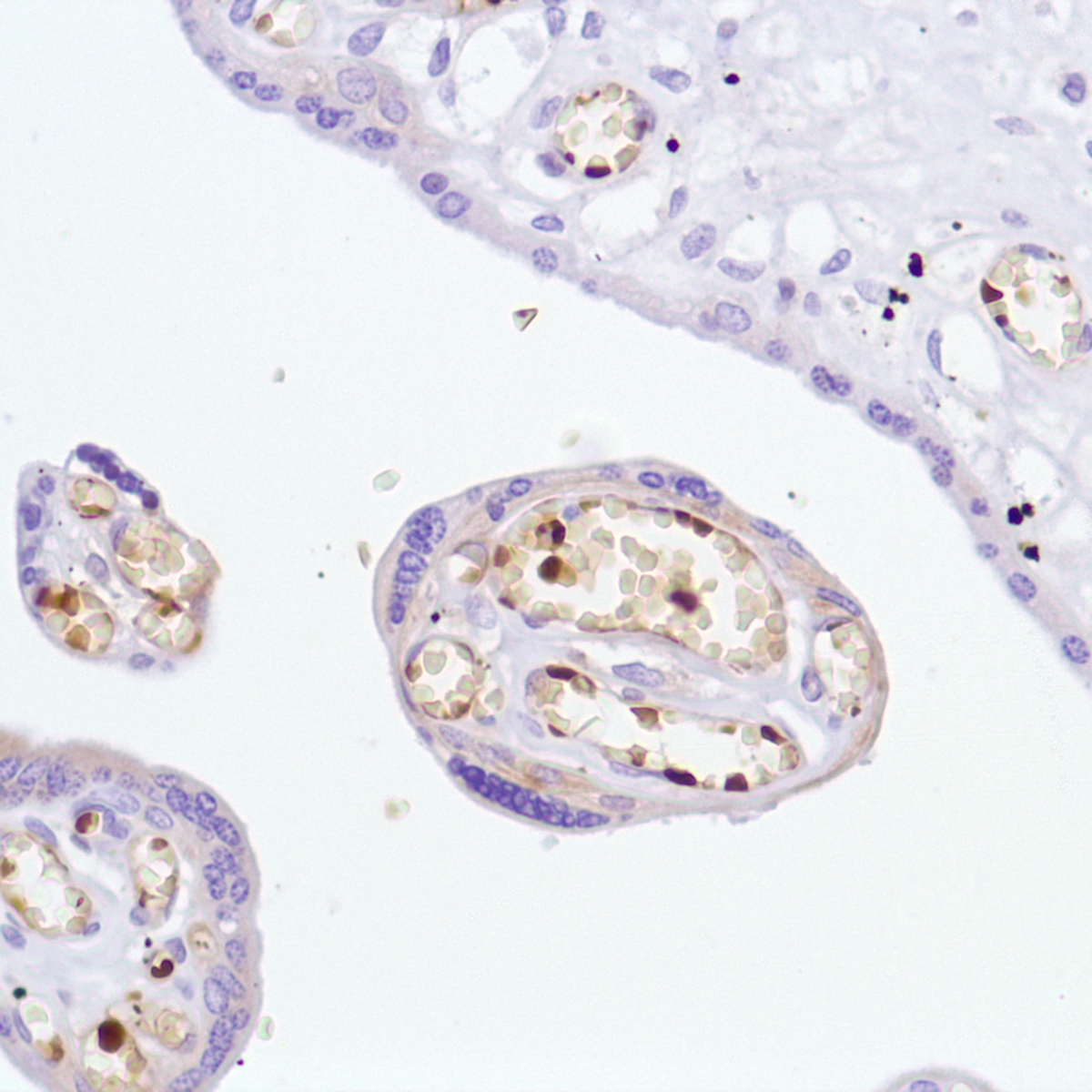 Human placenta stained with anti-hemoglobin alpha chain antibody