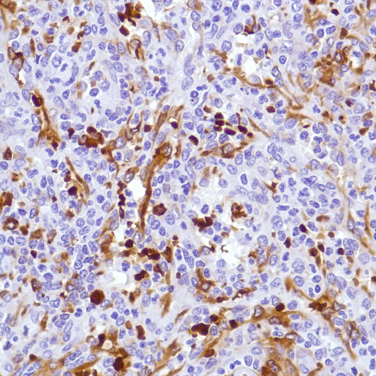 Human Spleen stained with anti-Hemoglobin Alpha antibody