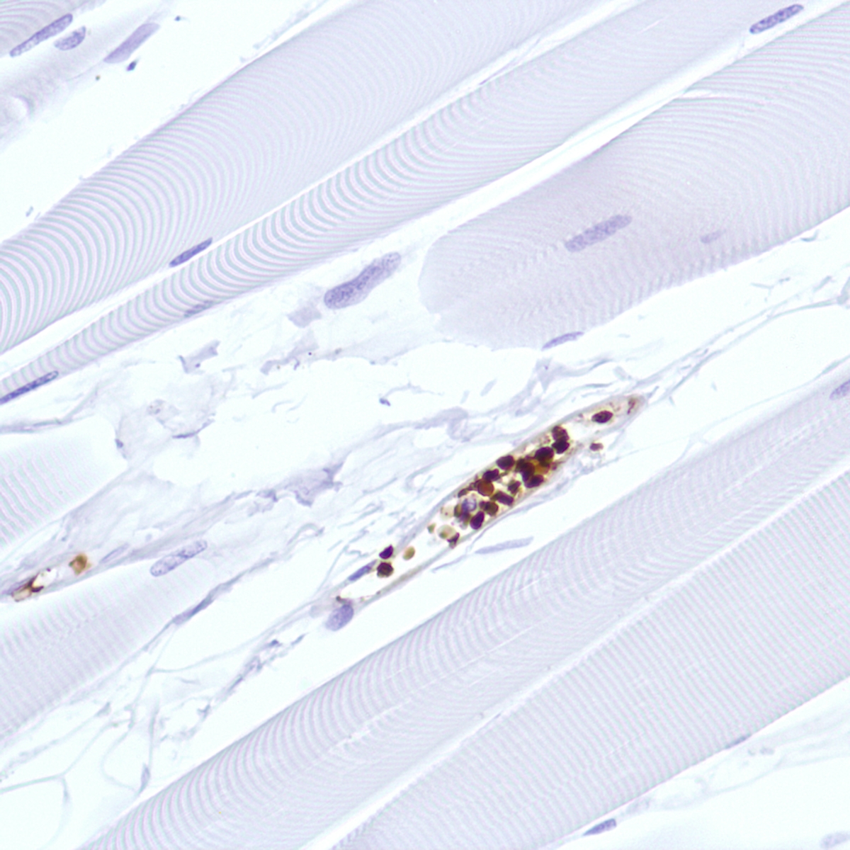 Human Skeletal Muscle stained with anti-Hemoglobin Alpha antibody