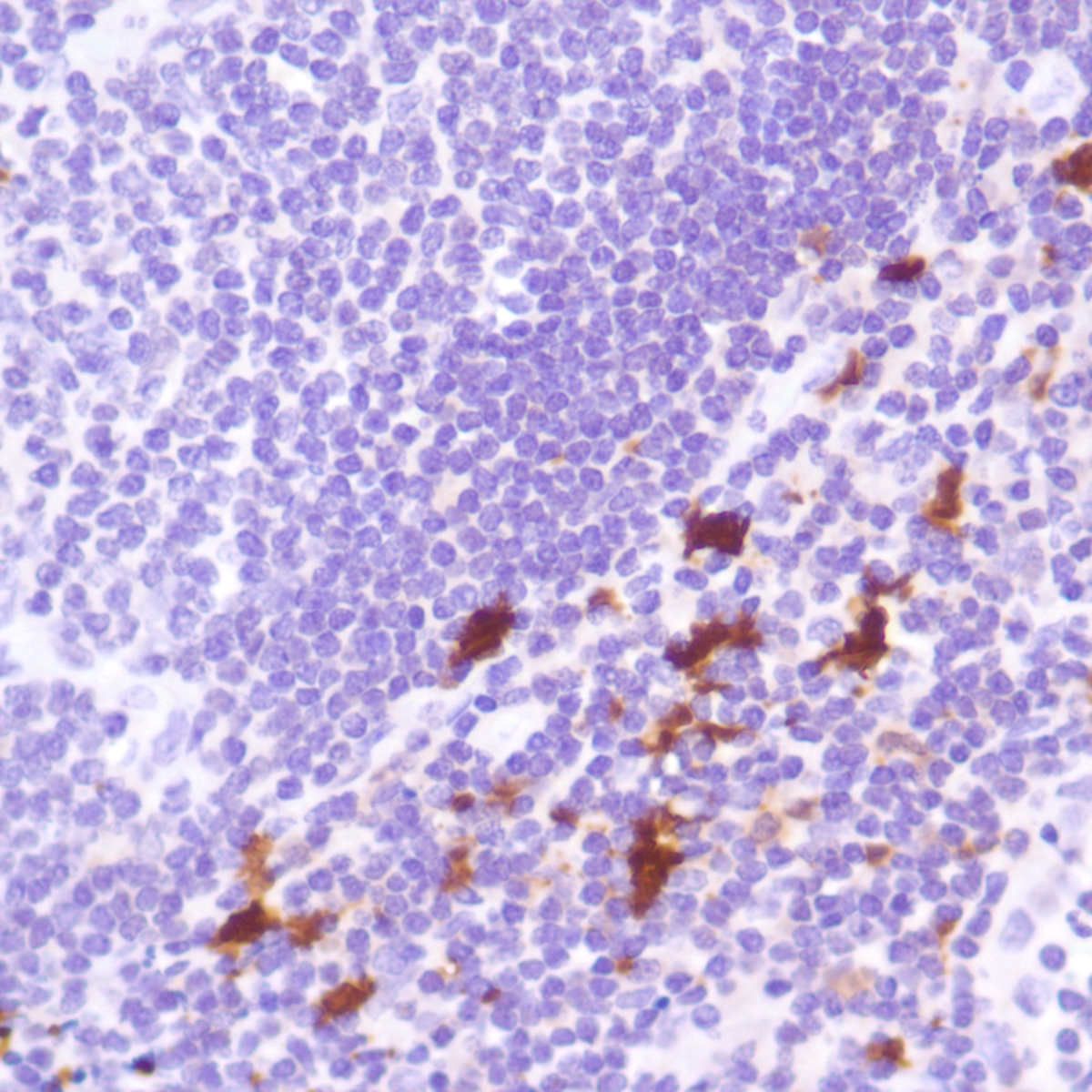 Human tonsil stained with anti-IDO-1 antibody