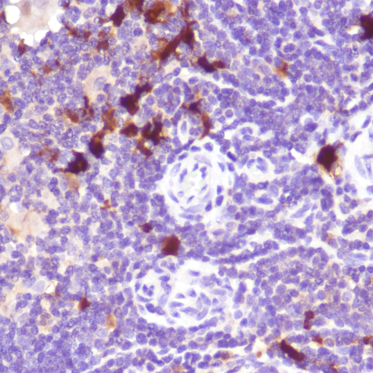 Human thymus stained with aniti-IDO-1 antibody