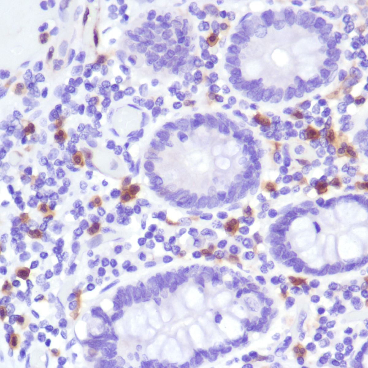 Human colon stained with anti-IDO-1 antibody