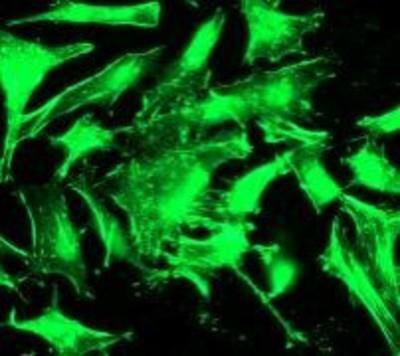 Immunocytochemistry/Immunofluorescence: Actin Alpha 1 Cardiac Muscle Antibody (EP184E) [NB110-55441] - HeLa cells.