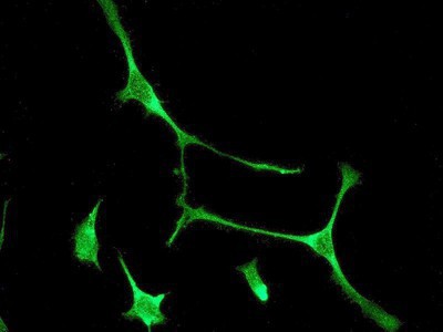 Immunocytochemistry/Immunofluorescence: EHD1 Antibody (EPR4954) [NBP1-95580] - HeLa cells.